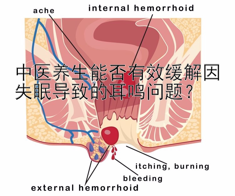 中医养生能否有效缓解因失眠导致的耳鸣问题？