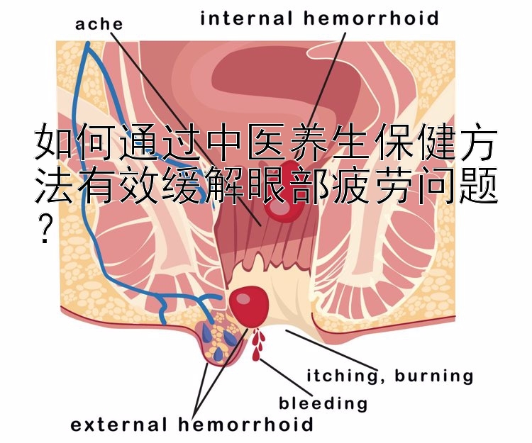 如何通过中医养生保健方法有效缓解眼部疲劳问题？